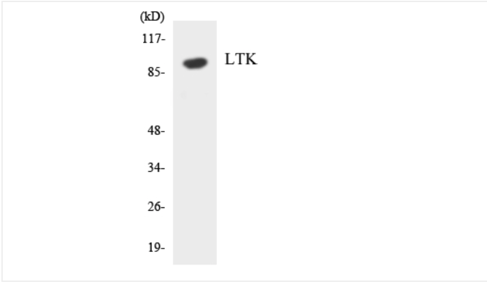 LTK Polyclonal Antibody - Size (µg) 50 - Galen Molecular